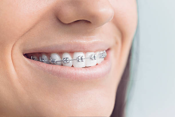 Best Wisdom Tooth Removal  in Demorest, GA